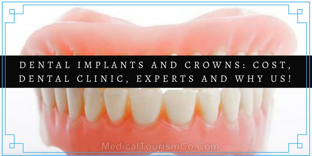 Cost-Dental-Clinic-Experts-and-why-us.jpg