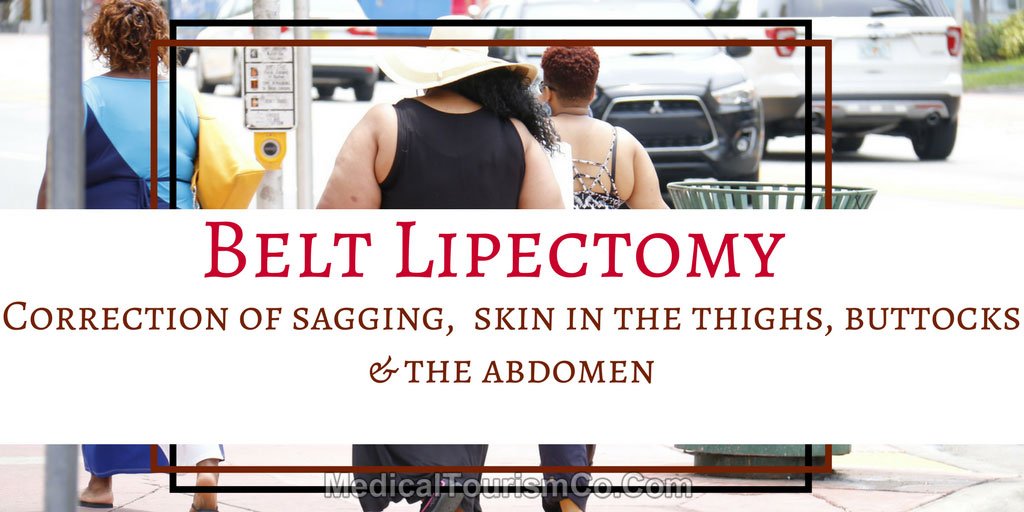 abdominal-lift-in-mexico.jpg