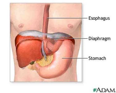 Epigastric Hernia Surgery Costs in Mexico, India & Costa Rica