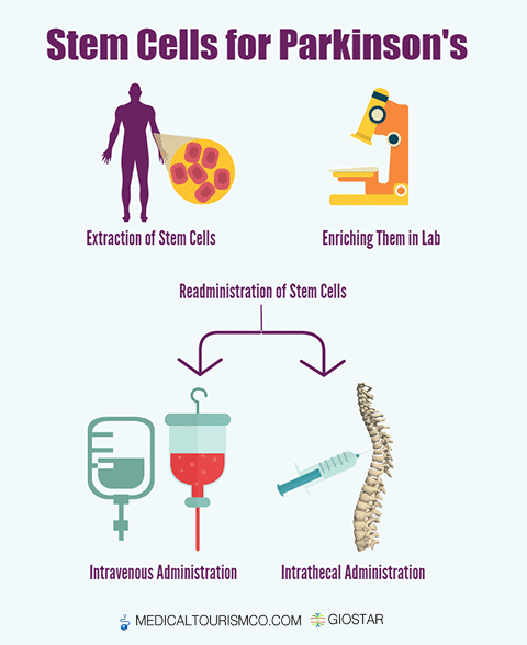 Stem Cell Treatment for Parkinson's in Mexico