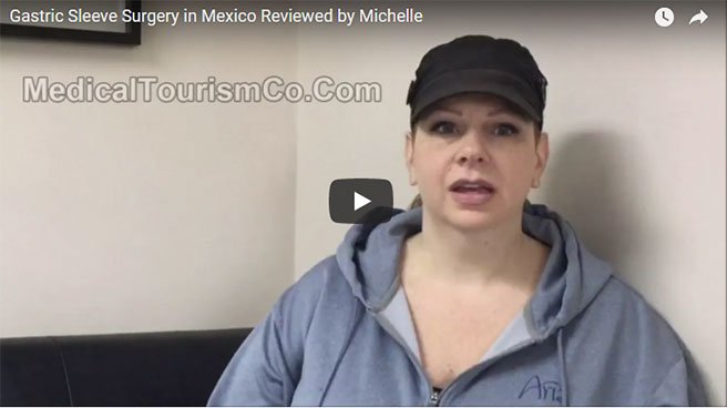 weight-loss-surgery-mexico-review-1.jpg