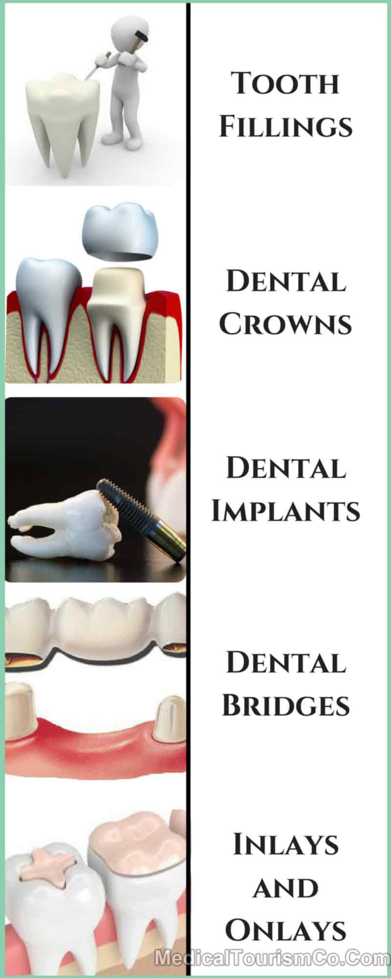 Procedures-in-Full-Mouth-Rehabilitation