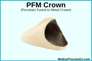 PFM Crown Chandigarh