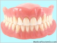 Removable Denture