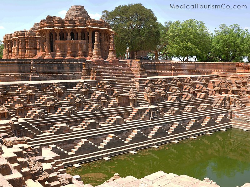 Modhera Step-Wells- Dental tourism in Ahmedabad