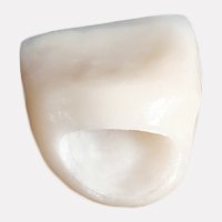 Zirconia Dental Crown in Los Cabos