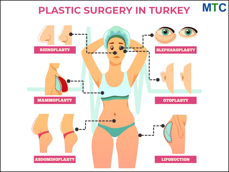 Plastic Surgery in Turkey