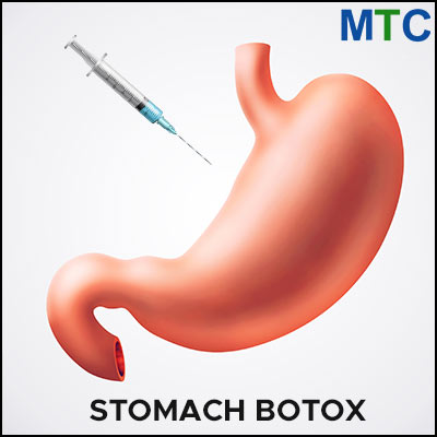 Stomach Botox