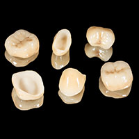 Ceramic crowns in Costa Rica