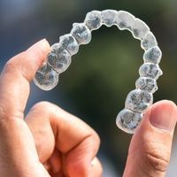 Aligners