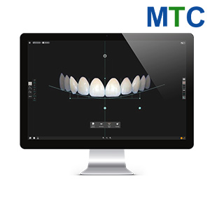 Digital Smile Design Turkey