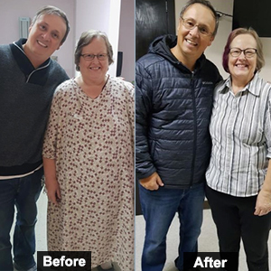 Before and after bariatric surgery by Dr. Hector Perez