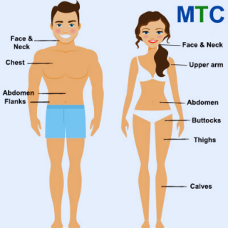 Target Areas for Liposuction