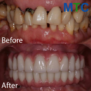 Magic of Cosmetic Dentistry