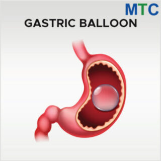 Gastric Balloon in Turkey