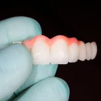 Dental bridges