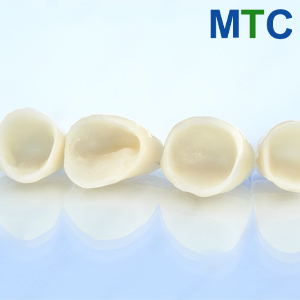 White coloured porcelain crowns